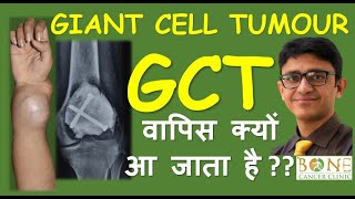 Giant Cell Tumour GCT Bone wapis kyun aa jaata hai  Factors affecting recurrence  Dr Rajat Gupta [upl. by Rebak727]