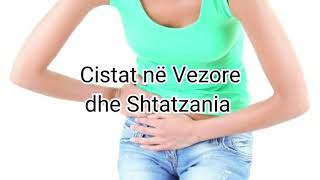 Cistet ne vezore dhe Shtatzania  Vezoret Policistike a ndikojne qe te mbeteni shtatzene [upl. by Kosaka]