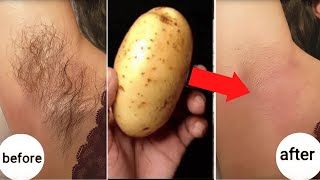 stop shaving here s how to permanently get rid of facial body and pubic hair [upl. by Mayer959]