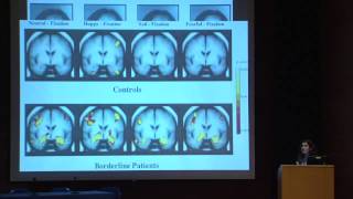 BPDrelated cognitiveperceptual difficulties and challenges in their diagnosis and treatment [upl. by Reniar622]