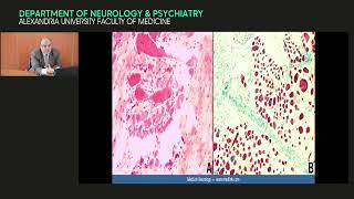 Neuromuscular disorders muscle and neuromuscular junction disorders  Prof Hazem Marouf [upl. by Jennifer]