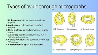 types of ovule  Bsc [upl. by Nairret]