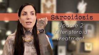 Sarcoidosis update 2 After topical steroid treatment [upl. by Llednahs983]