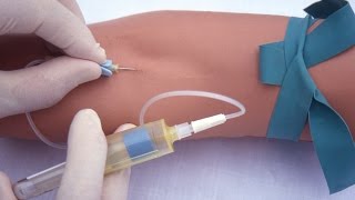 Performing a venipuncture using a butterfly needle [upl. by Kilk]