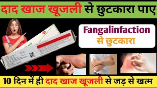 दाद खाज खुजली से छुटकारा पाए Fangalinfaction से छुटकारा Tenovate GN Cream Uses in hindi Riview [upl. by Nawd498]