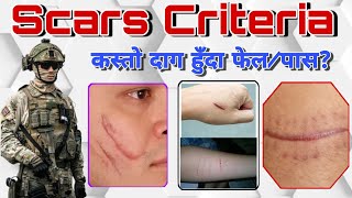 Scars Criteria Intake 2023 [upl. by Lorac]