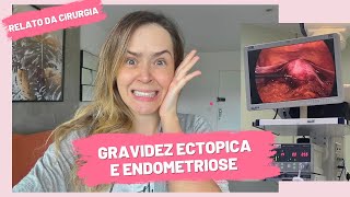 Relato da minha Cirurgia  Gravidez Ectópica e Endometriose [upl. by Missi]