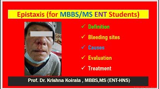 Epistaxis Dr Krishnas ENT Lectures  Dr Krishna Koirala  MBBS ENT lectures [upl. by Calvinna]