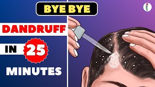 🔥1 Dandruff Treatment at Home  How to get rid of Dandruff  Dandruff Removal  Itchy scalp [upl. by Aeneus]