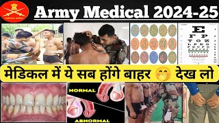 Agniveer Army Medical kase hota hai  Agniveer Army medical Test 2024 kaise check hota ha [upl. by Enelyw]