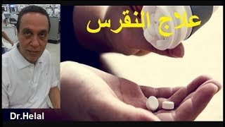 علاج النقرس  النقرس الحاد Acute Gout  النقرس المزمن Chronic Gout [upl. by Alilahk]