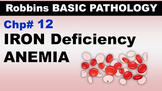 Ch12  Iron Deficiency Anemia  Blood Pathology  Dr Asif Lectures [upl. by Yrrak]