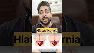 The Complete Guide to Hiatus Hernia What You Need to Know [upl. by Malvina]