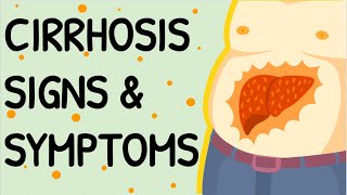 CIRRHOSIS Signs amp Symptoms [upl. by Akinoj]