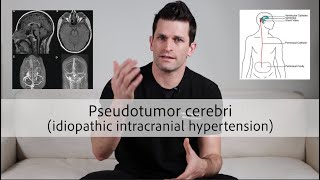 Pseudotumor cerebri idiopathic intracranial hypertension [upl. by Arras967]