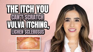 The Itch You Can’t Scratch Vulvar Itching Lichen Sclerosus [upl. by Liscomb]