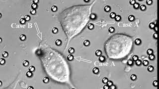 RAW2647 cells performing phagocytosis [upl. by Seibold]