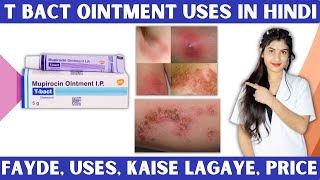 TBact Ointment Uses in Hindi  Mupirocin Ointment Ip Uses in Hindi  how To Use  Price  Uses [upl. by Jarrod465]