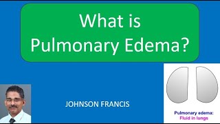 What is Pulmonary Edema [upl. by Mufinella]