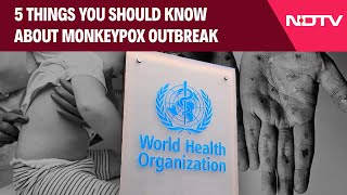 Monkeypox Virus  5 Things You Should Know About MonkeyPox Outbreak [upl. by Dyana]