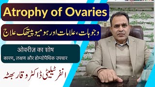 Atrophy of Ovaries  انڈے دانیوں کا سکڑ جانا Causes Symptoms and Homeo Treatment  urdu  hindi [upl. by Oninrutas]