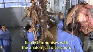 Gunther von Hagens BODY WORLDS Plastination Technique [upl. by Ummersen]