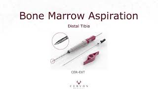 Bone Marrow Aspiration  Distal Tibia [upl. by Peppel]