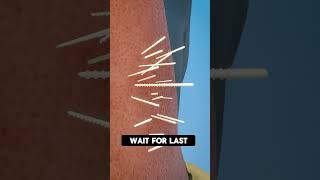 How to remove cholla cactus spines trending remove [upl. by Aisset]