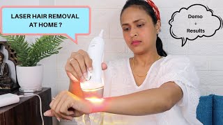 LASER HAIR REMOVAL AT HOME IPL Review amp Results 5 Weeks  Braun Silk Expert 5 [upl. by Ogait]