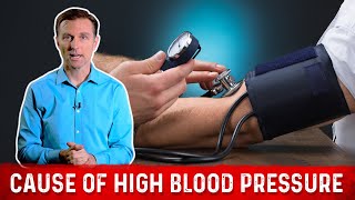 Real Cause Of High Blood Pressure Hypertension – Dr Berg [upl. by Dorsman]