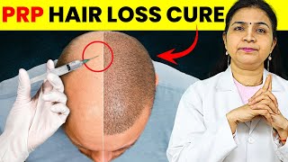 PRP Magic Hair Loss Treatment Before and After 2024  PRP Hair Treatment  PRP for Hair Loss [upl. by Anirdnajela]