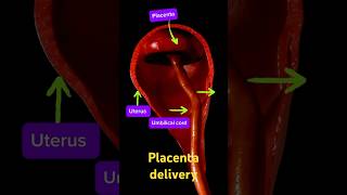 Delivery of the placenta pregnant placenta baby [upl. by Julius910]