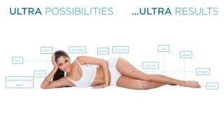 BTL Exilis Ultra™  An Ultra Opportunity [upl. by Herzog521]