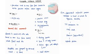 EXTERNAL CEPHALIC VERSION NOTES  OBSTETRICS  OBGY  ONE PAGE NOTES  4TH PROFF  MBBS [upl. by Enomsed]