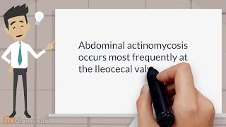 Where does abdominal actinomycosis occur most frequently [upl. by Elisabetta]