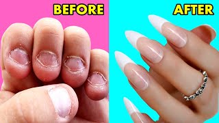 How To GROW Long Strong Nails Fast At Home  DIY Making Nails Strengthener Serum with home materials [upl. by Alfons]