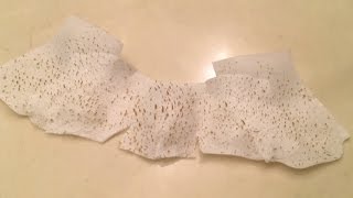 HOW TO MAKE PORE STRIPS WORK BETTER  Get Rid of Blackheads [upl. by Cone]