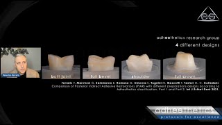 Intarsi vs Corone lo studio AdhestheticsquotClinica e Scienzaquot TRAILER ELITE CLUB [upl. by Assilana]