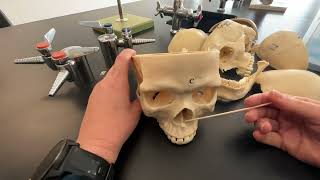 Skull Mandible and Maxilla bones and their bone markings [upl. by Uticas958]