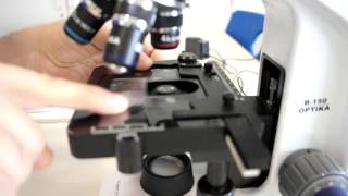 ALevel Biology Calibration of Eyepiece Graticule with stage micrometer [upl. by Enitsirc]