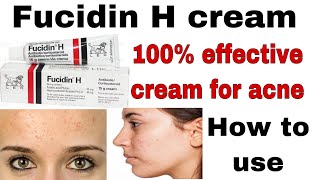 fucidin h cream uses in urdu For skin treatment of acne skin infectionsHow to use fusidin h cream [upl. by Artapoelc]