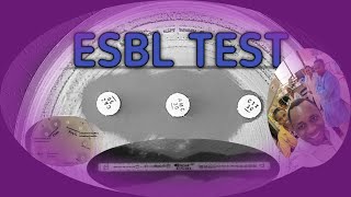 ESBL LABORATORY TESTS SWAHILI SBK [upl. by Leotie]