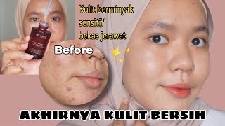 REVIEW AVOSKIN MIRACULOUS REFINING SERUM  Kulit jadi Glowing [upl. by Zetrauq934]