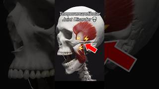 Temporomandibular Joint Dysfunction TMJ  TMD [upl. by Arem]