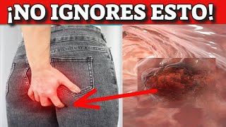 ¡CÁNCER de COLON SÍGNOS y SÍNTOMAS de ALERTA que NUNCA DEBES IGNORAR [upl. by Leshia274]