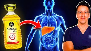 What CANOLA OIL does to your LIVER Influencers wont show you this [upl. by Rramel3]