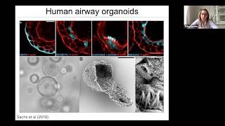 Dr Talya Dayton quotOrganoid models of neuroendocrine cell growth and tumorigenesisquot [upl. by Handal]