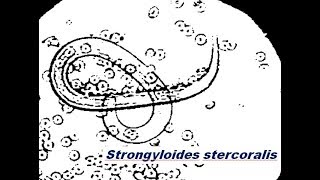 Strongyloides stercoralis [upl. by Yhprum]