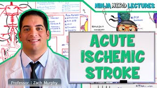 Acute Ischemic Stroke Etiology Pathophysiology Clinical Features Diagnostics Treatment [upl. by Christiano]