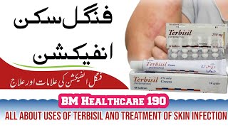 Uses of Terbisil Terbinafine Treatment of Fungal Skin Infection  Rashes  Tinea Cruris  In Urdu [upl. by Voss]